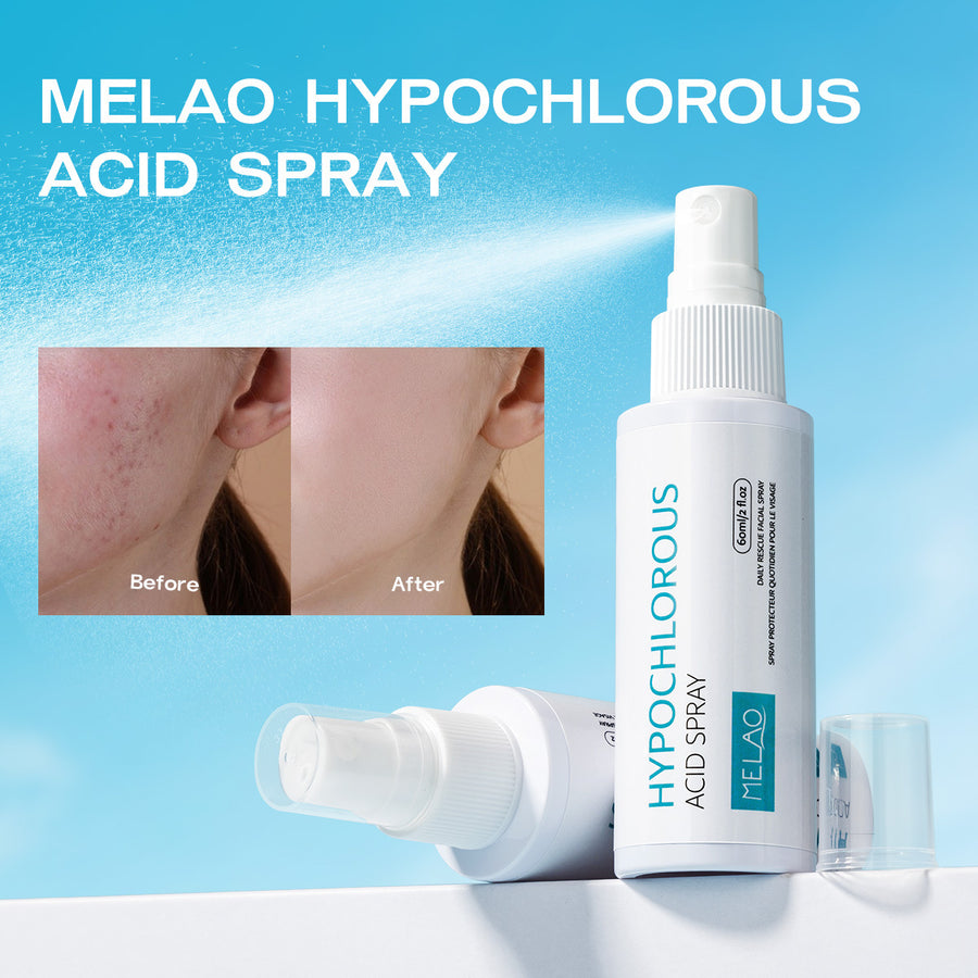 Hypochlorous Acid Face Mist — 60ml